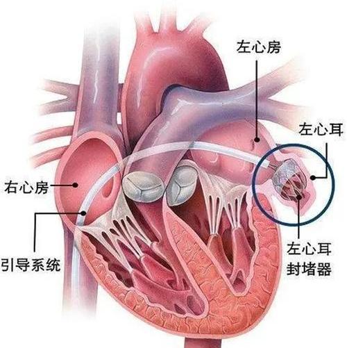 图片3.jpg